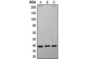 Western blot analysis of CD178 expression in A549 (A), K562 (B), HL60 (C) whole cell lysates. (FASL anticorps  (Center))