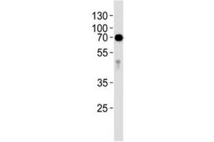Western blot analysis of lysate from human placenta tissue lysate using anti-Alkaline Phosphatase antibody diluted at 1:1000.