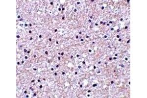 Immunohistochemistry (IHC) image for anti-Immediate Early Response 3 (IER3) (Middle Region) antibody (ABIN1030950) (IER3 anticorps  (Middle Region))