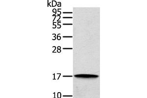 Western Blot analysis of Human cecum carcinoma tissue using REG3A Polyclonal Antibody at dilution of 1:200 (REG3A anticorps)