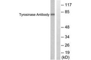 Western blot analysis of extracts from COS7 cells, treated with UV 30', using Tyrosinase Antibody. (TYR anticorps  (AA 471-520))