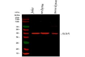 Western blot analysis of ADA using anti-ADA antibody (ABIN4886424). (ADA anticorps  (AA 135-363))