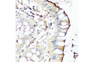 Immunohistochemistry of paraffin-embedded human colon using SERPINA7 antibody (ABIN5975019) at dilution of 1/100 (40x lens). (SERPINA7 anticorps)