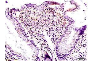 Formalin-fixed and paraffin embedded rat colon labeled with Anti Lpin1 Polyclonal Antibody, Unconjugated (ABIN672831) at 1:200 followed by conjugation to the secondary antibody and DAB staining.