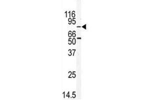 Western blot analysis of MARK2 antibody and mouse thymus tissue lysate