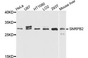 Western blot analysis of extracts of various cell lines, using SNRPB2 antibody. (SNRPB2 anticorps)