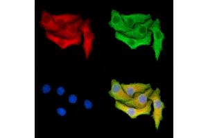 FAM62B Antibody staining Hela cells by IF/ICC.