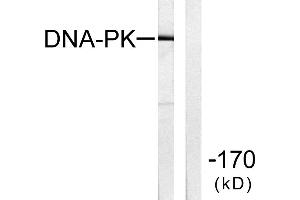 Western blot analysis of extracts from HeLa cells using DNA-PK antibody.