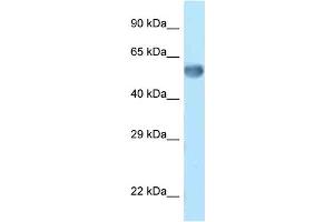 WB Suggested Anti-Zkscan14 Antibody Titration: 1. (ZNF394 anticorps  (C-Term))