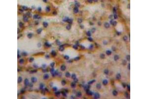 Used in DAB staining on fromalin fixed paraffin-embedded Kidney tissue (Luteinizing Hormone anticorps  (AA 25-120))