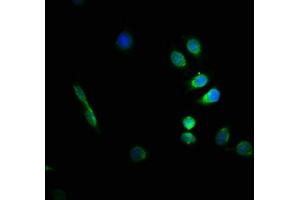 Immunofluorescence staining of A549 cells with ABIN7153853 at 1:66, counter-stained with DAPI.