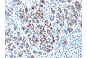 Formalin-fixed, paraffin-embedded human Pancreas stained with Alpha-1-Antichymotrypsin Mouse Monoclonal Antibody (AACT/1451) (SERPINA3 anticorps  (AA 49-187))