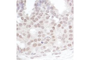 Immunohistochemistry (IHC) image for anti-Gem (Nuclear Organelle) Associated Protein 4 (GEMIN4) (C-Term) antibody (ABIN7453863)