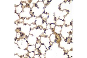 Immunohistochemistry of paraffin-embedded mouse lung using ASPSCR1 antibody (ABIN5975297) at dilution of 1/100 (40x lens). (ASPSCR1 anticorps)