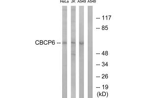 Western blot analysis of extracts from HeLa cells, Jurkat cells and A549 cells, using CBCP6 antibody. (AGBL4 anticorps  (C-Term))