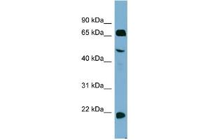 WB Suggested Anti-ZNF746 Antibody Titration:  0. (ZNF746 anticorps  (Middle Region))