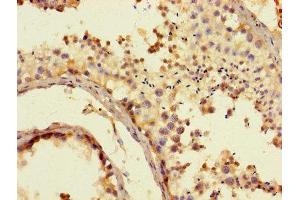 Immunohistochemistry of paraffin-embedded human testis tissue using ABIN7170749 at dilution of 1:100 (CYP17A1 anticorps  (AA 1-508))