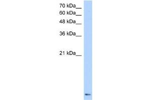 WB Suggested Anti-ZNF706 Antibody Titration:  0. (ZNF706 anticorps  (N-Term))