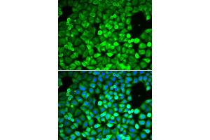 Immunofluorescence analysis of A549 cell using IPO5 antibody. (Importin 5 anticorps  (AA 20-300))