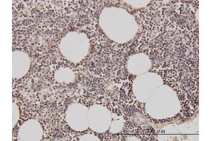 Immunoperoxidase of monoclonal antibody to GMNN on formalin-fixed paraffin-embedded human lymph node.