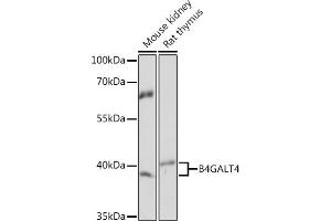 Western blot analysis of extracts of various cell lines, using B4G Rabbit pAb (ABIN7271201) at 1:1000 dilution. (B4GALT4 anticorps  (AA 35-344))