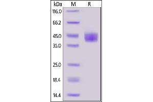 Cynomolgus Mesothelin (296-580), His Tag on  under reducing (R) condition.
