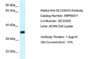 Western Blotting (WB) image for anti-Solute Carrier Family 25, Member 33 (SLC25A33) (Middle Region) antibody (ABIN2788474) (SLC25A33 anticorps  (Middle Region))