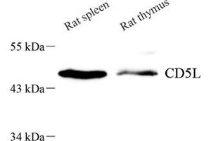 Western blot analysis of CD5L (ABIN7073398) at dilution of 1: 700 (CD5L anticorps)