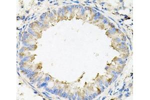 Immunohistochemistry of paraffin-embedded Mouse lung using CALU Polyclonal Antibody at dilution of 1:100 (40x lens).