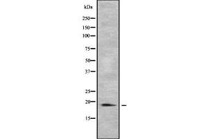 Western blot analysis of PTRH2 using COLO205 whole cell lysates (PTRH2 anticorps  (Internal Region))