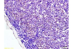 Formalin-fixed and paraffin embedded mouse colon labeled with Anti-AMPK alpha-1/PRKAA1 Polyclonal Antibody, Unconjugated (ABIN737886) at 1:200 followed by conjugation to the secondary antibody and DAB staining. (PRKAA1 anticorps  (AA 351-450))