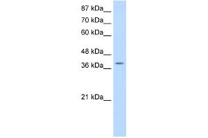 WB Suggested Anti-MYST4 Antibody Titration:  0. (KAT6B anticorps  (N-Term))
