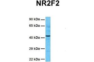 Host:  Rabbit  Target Name:  NR2F2  Sample Tissue:  Human Fetal Liver  Antibody Dilution:  1.