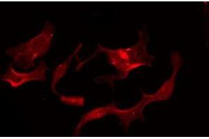 ABIN6275954 staining Hela by IF/ICC. (G Protein-Coupled Receptor 119 anticorps  (Internal Region))