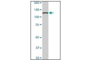 Western Blotting (WB) image for anti-Homeodomain Interacting Protein Kinase 2 (HIPK2) antibody (ABIN781914) (HIPK2 anticorps)