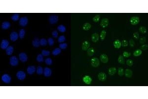 IF analysis of RCC1 using anti-RCC1 antibody (ABIN7600022). (RCC1 anticorps  (AA 14-421))