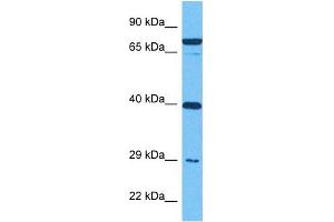 Host:  Rabbit  Target Name:  IGFBP4  Sample Tissue:  Human MDA-MB-435s Whole Cell  Antibody Dilution:  1ug/ml (IGFBP4 anticorps  (Middle Region))