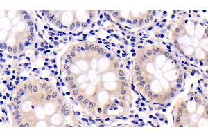 Detection of ERK2 in Human Colon Tissue using Monoclonal Antibody to Extracellular Signal Regulated Kinase 2 (ERK2)