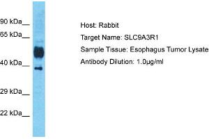 Host: Rabbit Target Name: SLC9A3R1 Sample Tissue: Human Esophagus Tumor Antibody Dilution: 1ug/ml (SLC9A3R1 anticorps  (C-Term))