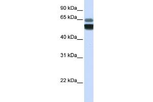 Western Blotting (WB) image for anti-Sphingomyelin phosphodiesterase 1, Acid Lysosomal (SMPD1) antibody (ABIN2458155) (SMPD1 anticorps)