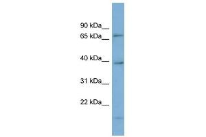 HP1BP3 antibody used at 1 ug/ml to detect target protein. (HP1BP3 anticorps  (Middle Region))