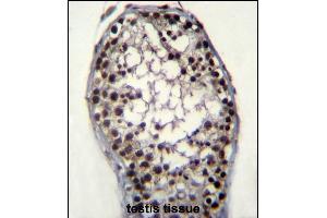 anti-Glycerol Kinase (GK) (AA 24-51), (N-Term) antibody