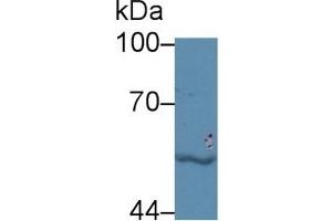 Detection of LBP in Human Jurkat cell lysate using Polyclonal Antibody to Lipopolysaccharide Binding Protein (LBP)