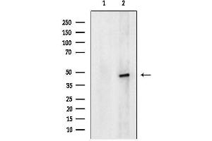 anti-Suppressor of Variegation 3-9 Homolog 1 (Drosophila) (SUV39H1) (C-Term) antibody
