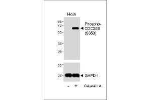 Western blot analysis of lysates from Hela cell line, untreated or treated with 20 % FBS + 100nM Calyculin A, 15 min, using Phospho-CDC25B Antibody (upper) or GDH(lower). (CDC25B anticorps  (pSer353))