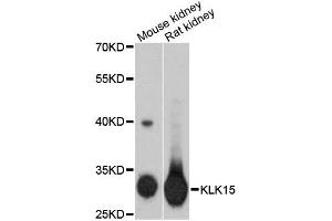 Western blot analysis of extracts of various cell lines, using KLK15 antibody (ABIN1873439) at 1:3000 dilution. (Kallikrein 15 anticorps)