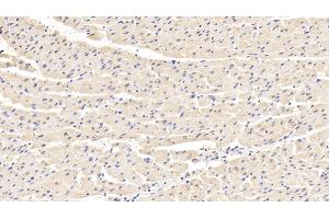 Detection of LDHB in Human Cardiac Muscle Tissue using Polyclonal Antibody to Lactate Dehydrogenase B (LDHB)