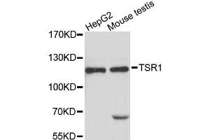 Western blot analysis of extracts of various cell lines, using TSR1 antibody. (TSR1 anticorps)