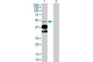 Western Blot analysis of NR4A1 expression in transfected 293T cell line by NR4A1 MaxPab polyclonal antibody. (NR4A1 anticorps  (AA 1-598))