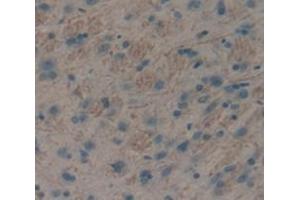IHC-P analysis of Rat Tissue, with DAB staining. (Insulin Receptor anticorps  (AA 1114-1382))